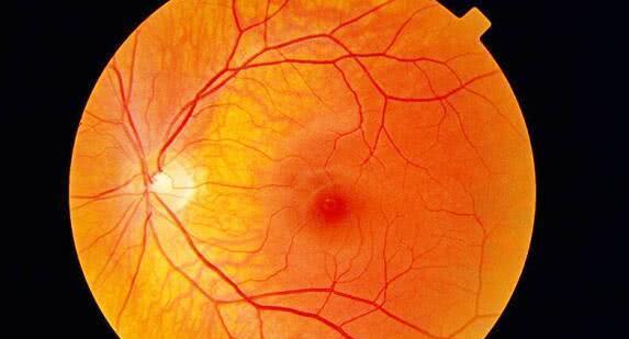 「感光细胞」人类真是被设计出来的吗?科学家拿出一个“铁证”,告诉你答案