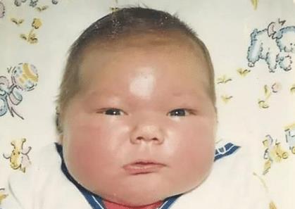 :曾轰动一时的7公斤“巨婴”,如今36年过去了,他成这般