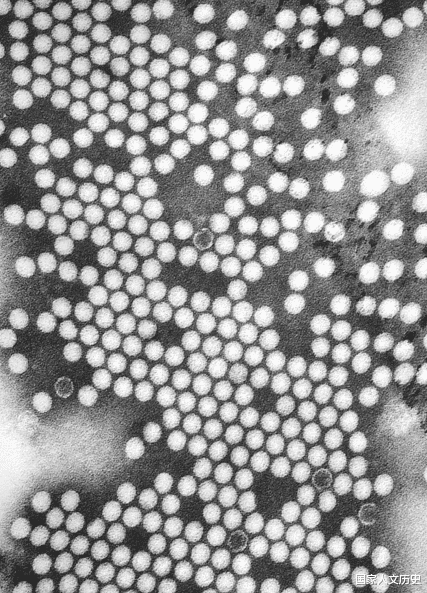 『美国』这个病毒曾经困扰美国人很久，病人不得不住进这种“机器监狱”