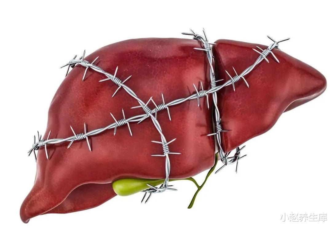 『肝脏』肝病“不痛不痒”，出现4种表现，趁早去查下肝功，小心发生癌变