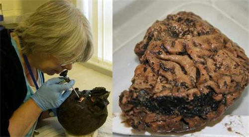 「英国」英国出土一颗“活着的大脑”，距今2600年，里面藏着什么秘密