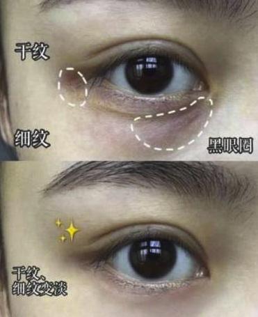 [眼霜]赵露思素颜直播，看了她“涂眼霜”的方法，难怪她眼睛白嫩无皱纹