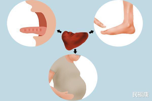 祛湿■天然的祛湿王发现了！每天吃几口，祛湿排毒，大肚腩也消失了