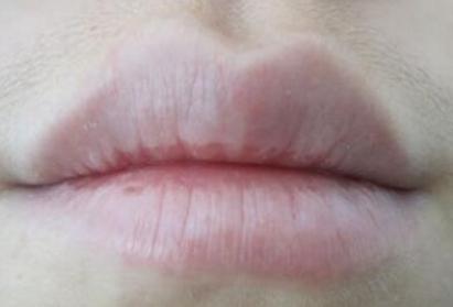 肝脏|肝不好，嘴先知！嘴部出现4种异常，多半肝脏已经开始\病变\
