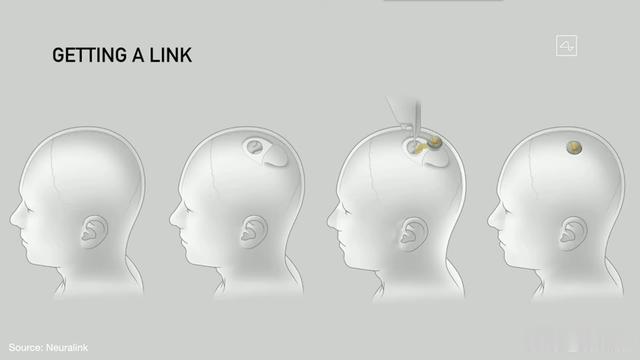 neuralink|马斯克已经把芯片安到了猪脑里,“脑控游戏”距离我们还有多远?