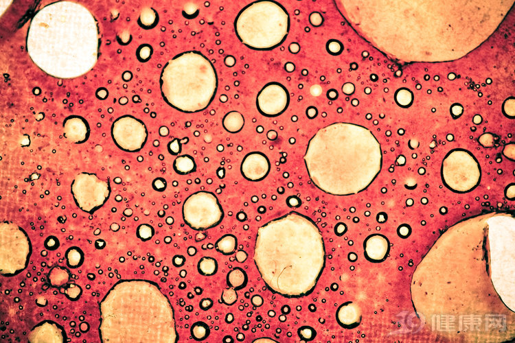 癌细胞|癌症复发转移就没救了？新疗法或带来希望：患者无癌生存19个月