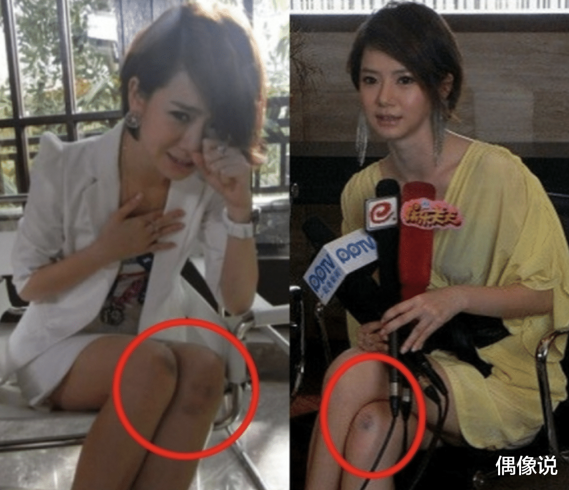 偶像说|戚薇坐轮椅现身医院，多名工作人员护驾，面容憔悴疑身体出问题