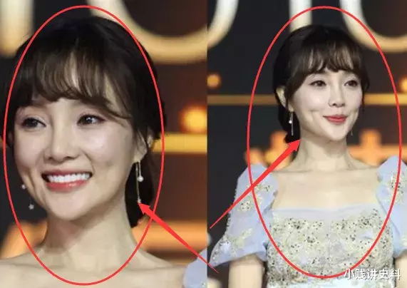 「王心凌」被玻尿酸“毁掉”的女明星！李小璐不自然，王心凌不能笑，而她让人怀疑眼睛