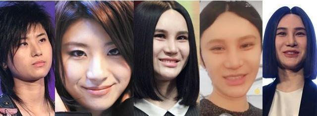 【整容】被玻尿酸毁了的六大女星,王心凌像老太太,而她丑到不能接受