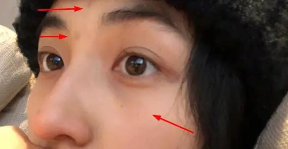 张子枫|张子枫不愧是“张不修”，晒自拍额头痘印都不p，脸上还有雀斑