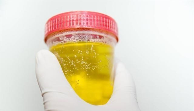 运动|肝病“元凶”被找到!专家坦言:与饮酒无关,1种水果,要扔掉