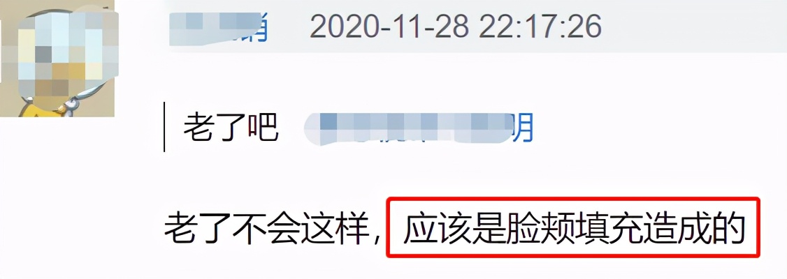 谢娜|谢娜的脸怎么了？笑起来眼角出现奇怪大坑，引网友整容猜疑