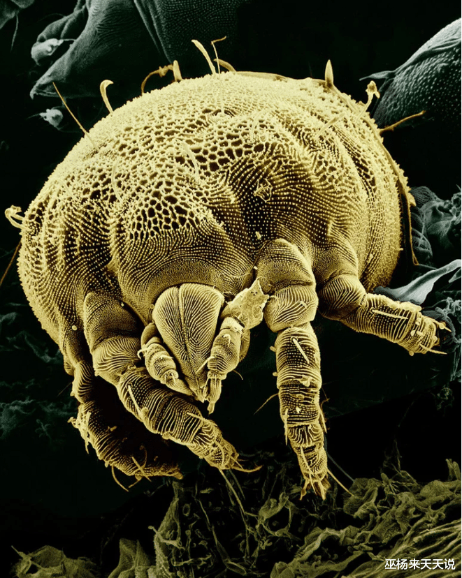 显微镜|22张显微镜下看到的奇妙的照片，看完还敢这样刮胡子吗？