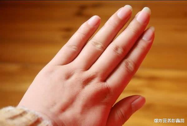 颈椎病@长期“手脚发麻”的人，除了颈椎病以外，还有排查4种常见症状