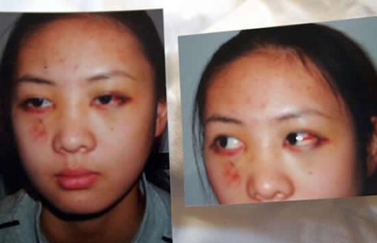 童瑶|童瑶被张默打是因为什么 童瑶和张默分手原因曝光