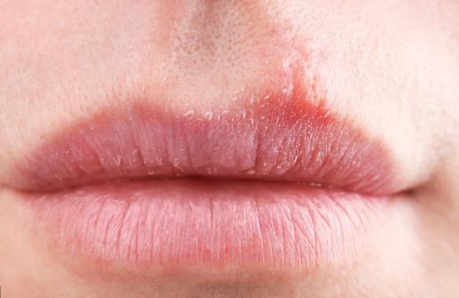 口臭|中医提醒，肝火旺盛，除了口臭，嘴巴还会有4种表现，需警惕