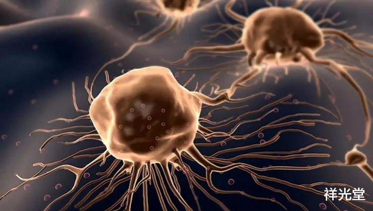 「肺癌」咳嗽时出现“这种感觉”，可能是肺癌的表现，早知道早重视