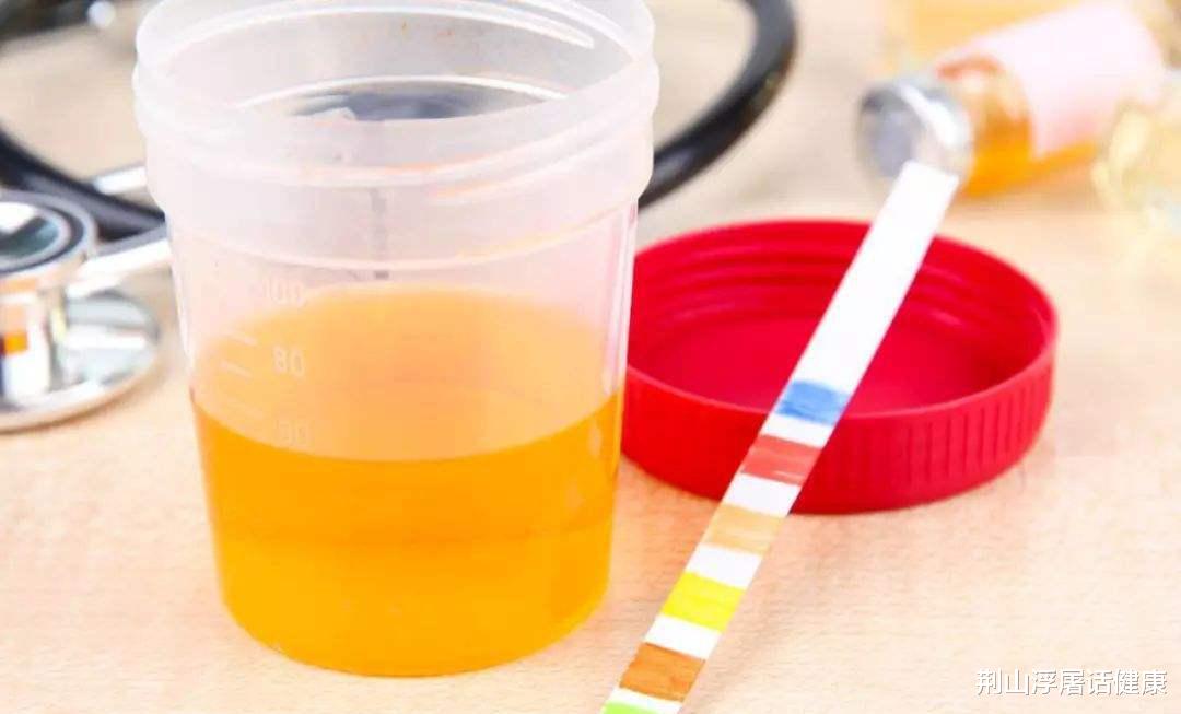 肝脏|肝病的“天敌”找到了，不是大蒜，每天敞开喝，肝脏悄悄变干净