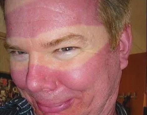 『特朗普』为什么特朗普的眼袋是白色的?