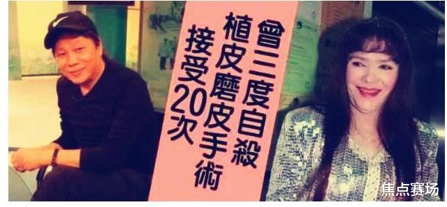 梁小龙|梁小龙散尽家财，只为治好妻子被硫酸毁容的脸，为何又转身抛弃？