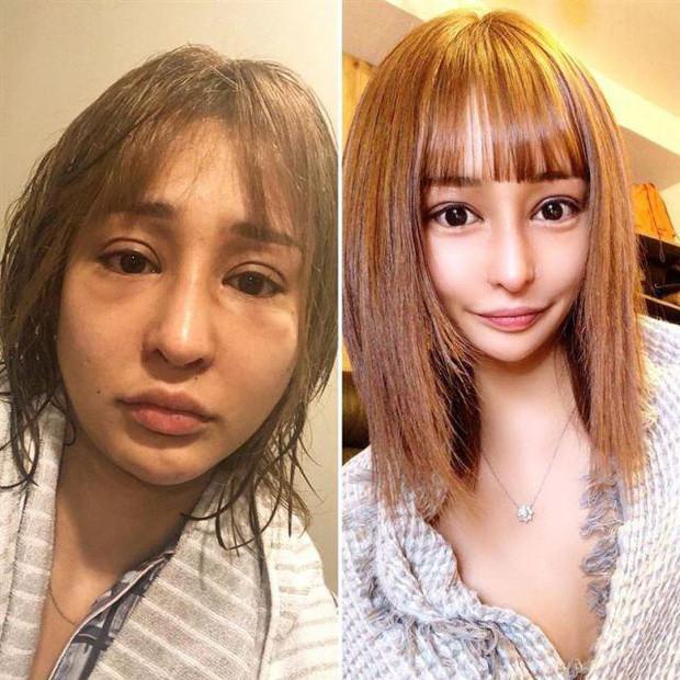 睹图|女子因长相丑陋遭嘲笑，十年整容上百次，如今成老板月入四千多万