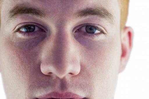 【黑眼圈】肾不好都写在脸上，脸上出现4种状况要注意，3件事不能再做了