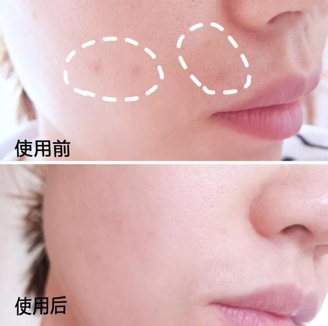 「李佳琦」李佳琦晒的“续命”精华液火了，张嘉倪同款！用后色斑细纹消失了