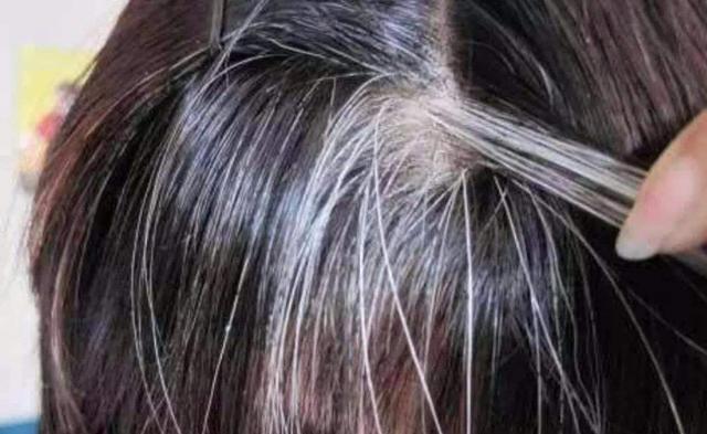 白发：白发出现在哪里“最危险”？白发生长的地方，暴露了身体隐患！