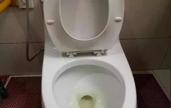 永康人 一勺白醋解决厕所臭味问题,赶紧学起来吧!