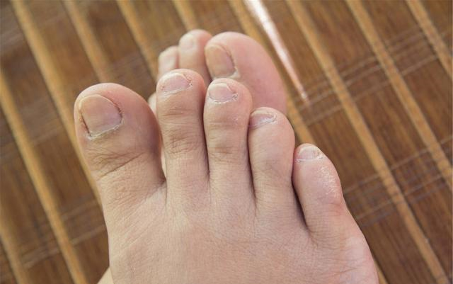 疾病@“肾”好不好，低头看看脚？若没有3痕迹，偷着乐吧，肾脏很强壮