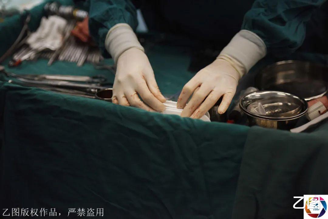 民警：移花接木，男子打工意外切断手指，医生成功将其脚趾接到手上