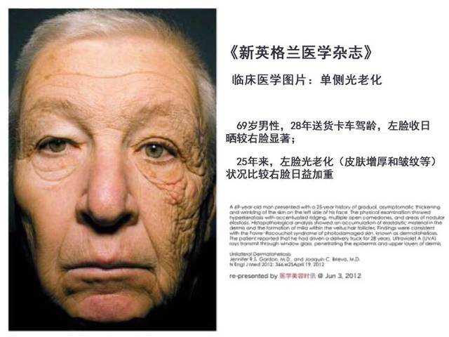 [护肤品]?护肤品越用越多，肌肤状态急剧下滑，护肤品真的有效？