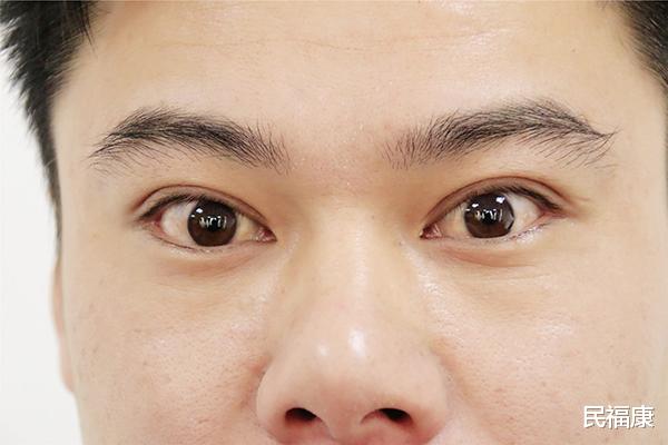 肝癌|肝癌不是“静悄悄”找上你的，或许1年前就提醒你了，却被忽视了