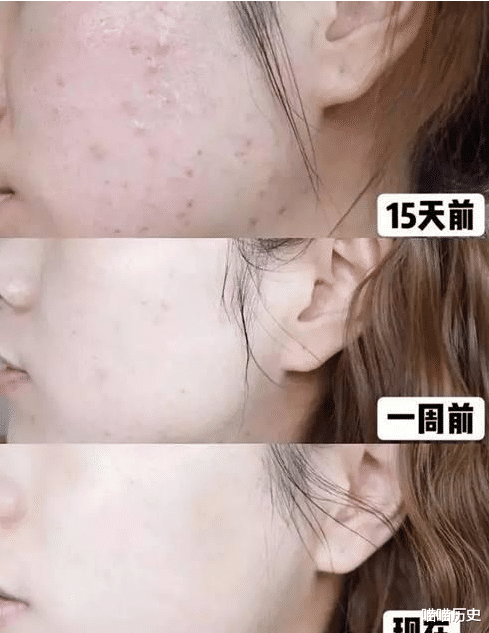 氨基酸|自以为是在护肤，其实很“伤”皮肤的4种习惯，难怪皮肤一直不好