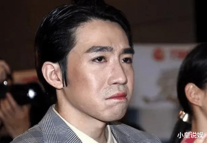 俞灏明|俞灏明自曝烧伤后第一个去探望自己的人,并发誓这辈子都不会忘记