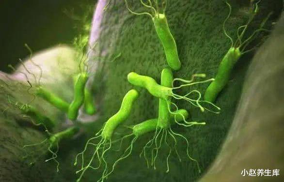 「幽门螺杆菌」幽门螺杆菌的“克星”找到了,多吃一口也行,给你的胃排排毒!