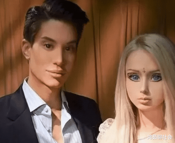 [美国]还记得花154万植入“翅膀”的美国男子，现状如何？网友：人生赢家！