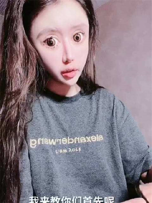 韩国整容|还记得13岁就赴韩国整容的女孩吗？3年整60次，如今模样让人唏嘘