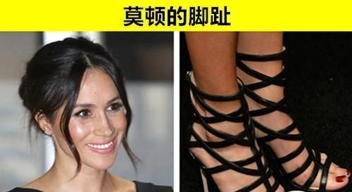 牙齿|“万中无一”的身体：也许大多数人身体上都没有的10个罕见特征