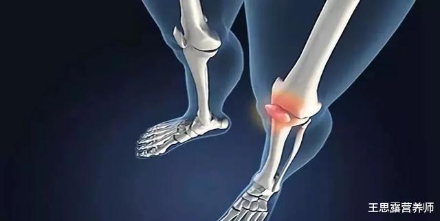 运动|痛风病人如何运动?医生老实说:尿酸很怕这些运动,多做能降尿酸