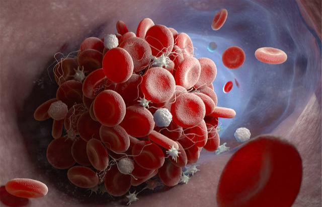 胆固醇|胆固醇高的不止肥肉，这3类食物，多吃一口都不行，不然血脂飙升