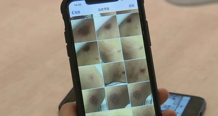 『滕州』年近七旬大伯美容店享受私人定制项目，花掉576万！妻子崩溃了…