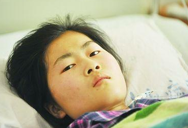 #肝脏#19岁女子腹大如鼓，查出肝癌，提醒：出现4种迹象，及时检查肝脏