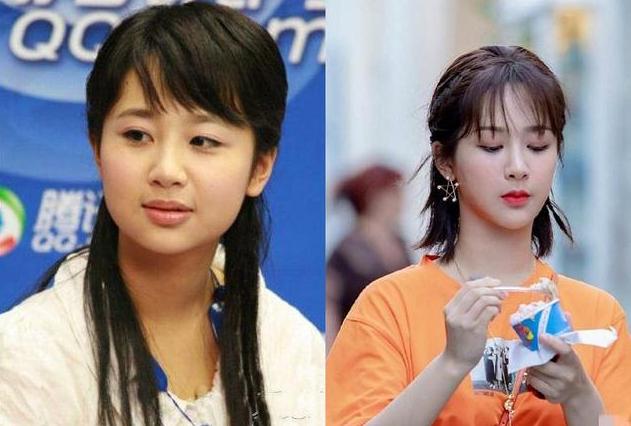 杨紫|继李小璐和杨紫后，又一女明星被拍到去整形医院，唯独她大方承认
