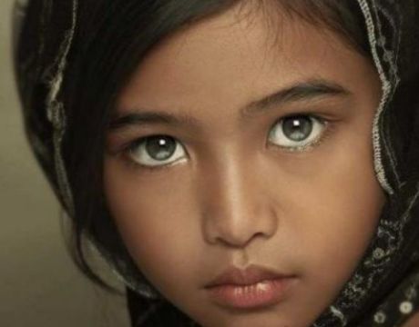 科学家|人可能有三只眼睛吗？印度小女孩“第三只眼”，科学家也无法解释