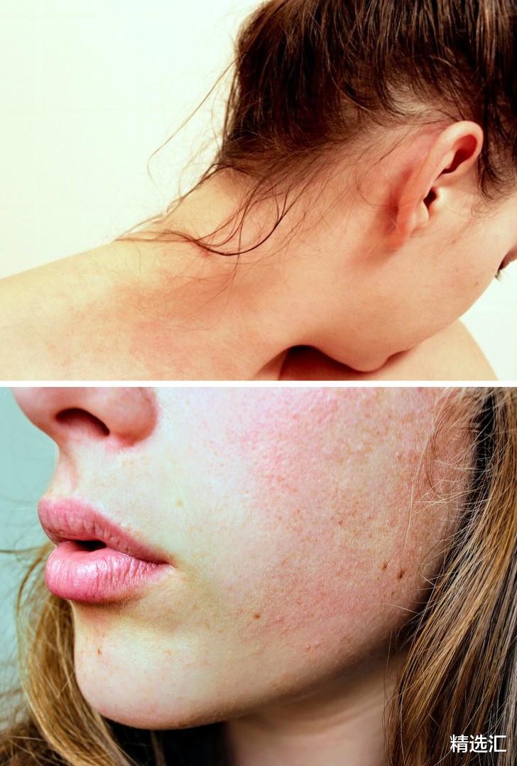 [人工甜味剂]我们不应该带着湿头发睡觉的7个理由