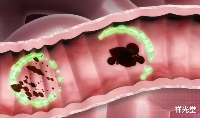「烤肉」伤肠道“最厉害”的食物，不是酒，也不是烤肉，原来是这二种