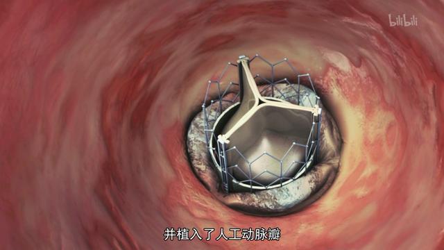[罗宾]明星死后的尸检，究竟能揭开多少真实到可怕的秘密？