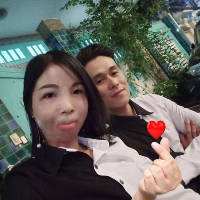 睹图|女孩10岁时遭遇意外毁容,如今与帅气男友网恋4个月后订婚