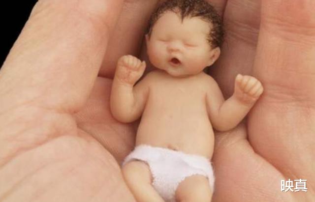 映真|出生时身长25厘米重280克，如今18岁的“拇指姑娘”咋样了